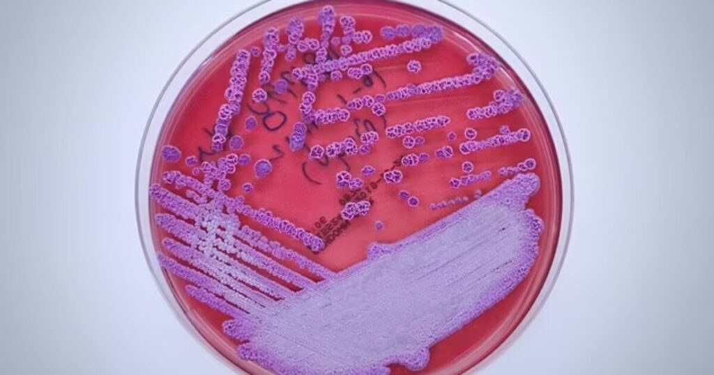 Fatal Bacteria Threatening Half of Gulf Coast Patients, CDC Issues Alert