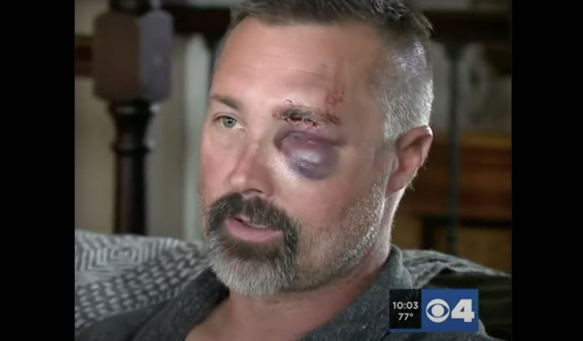 Shocking Video: Man Brutally Attacked by Gang in Front of Wife – You Won't Believe What Happened to His Eyelid!